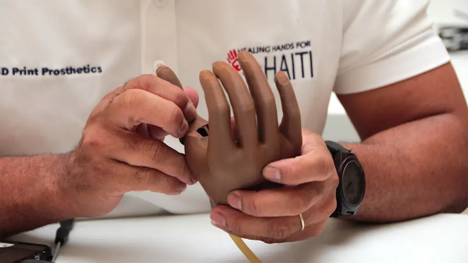Clinician assembling the prosthetic arm