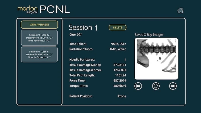 Image of statistics from a training session in Marion Surgical’s VR surgery simulator