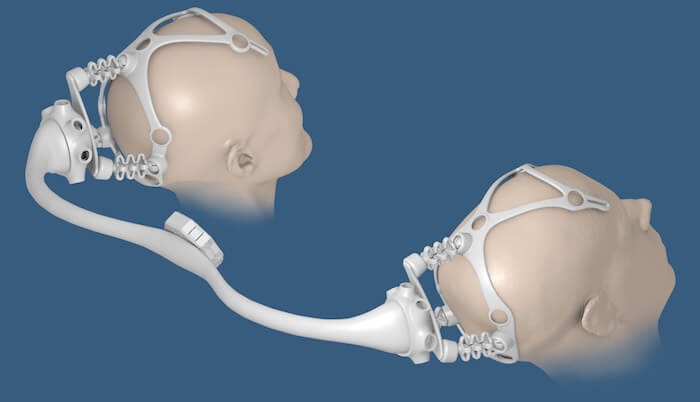 3D rendering of the headsets used in Dual Brains. 