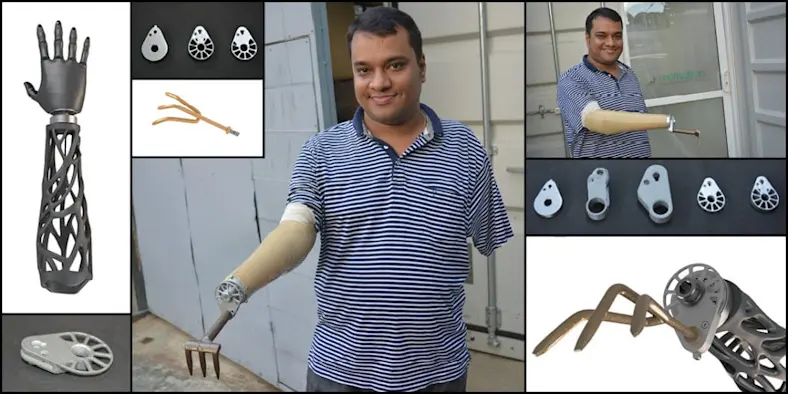Prosthetics start-up supports amputees in India with helping hands