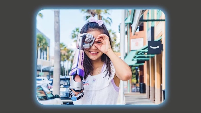 Young girl smiles while peering through imaginary binoculars using her hand and her Limbitless prosthetic arm.