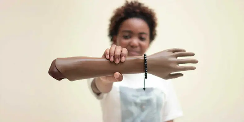 prosthetic technology examples