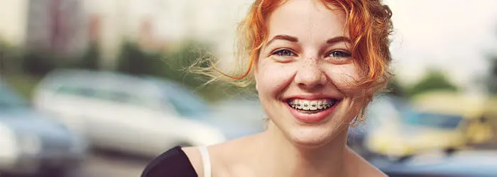 Consigli dei genitori sugli apparecchi dentali