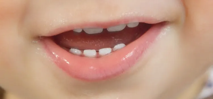 Denti decidui