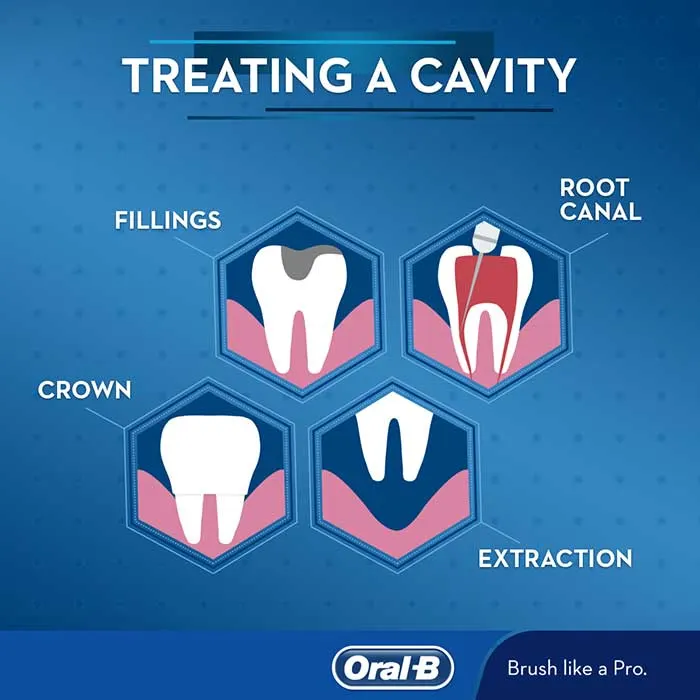 Un’infografica di Oral-B con quattro opzioni di trattamento per la carie