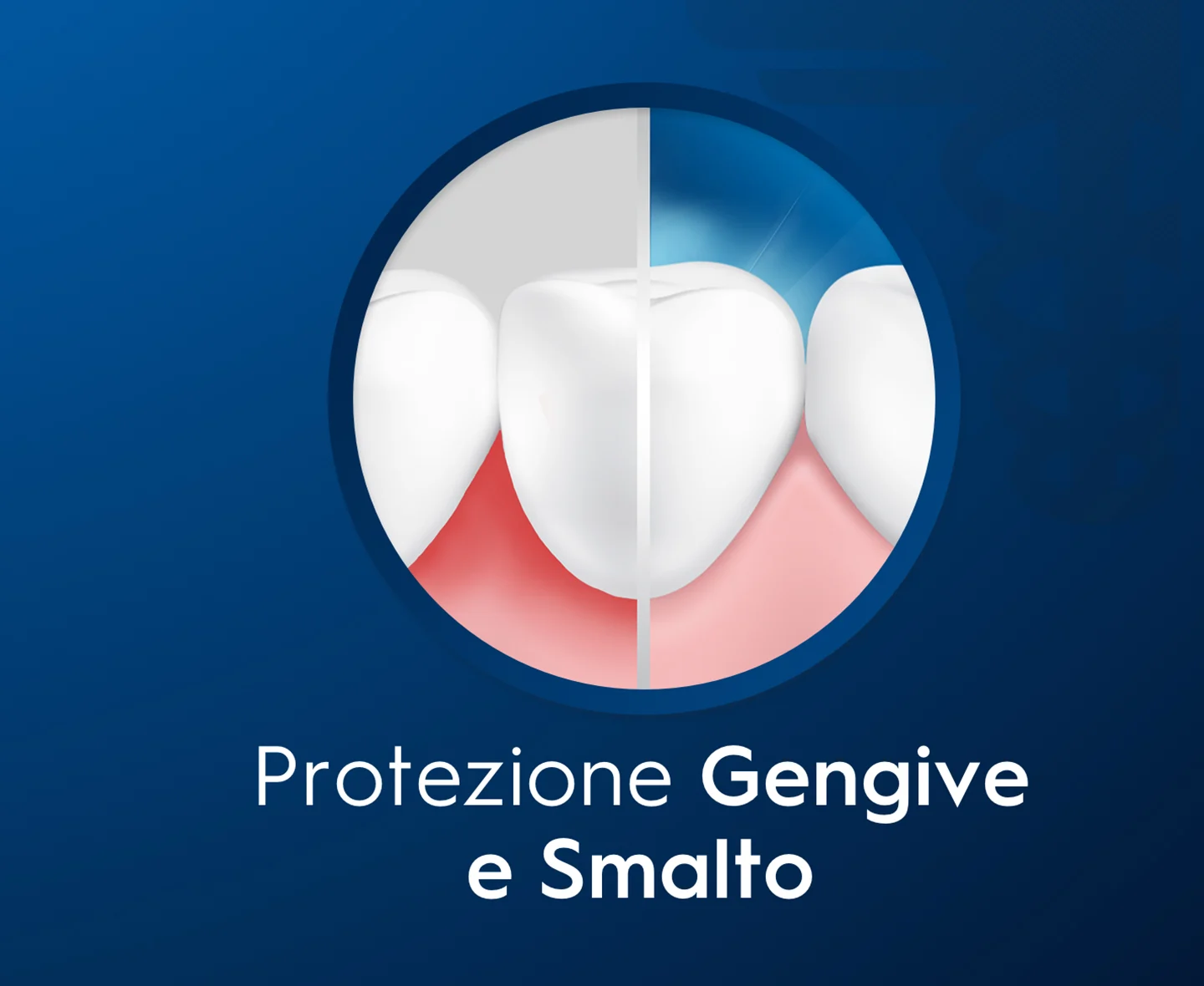Gengive
