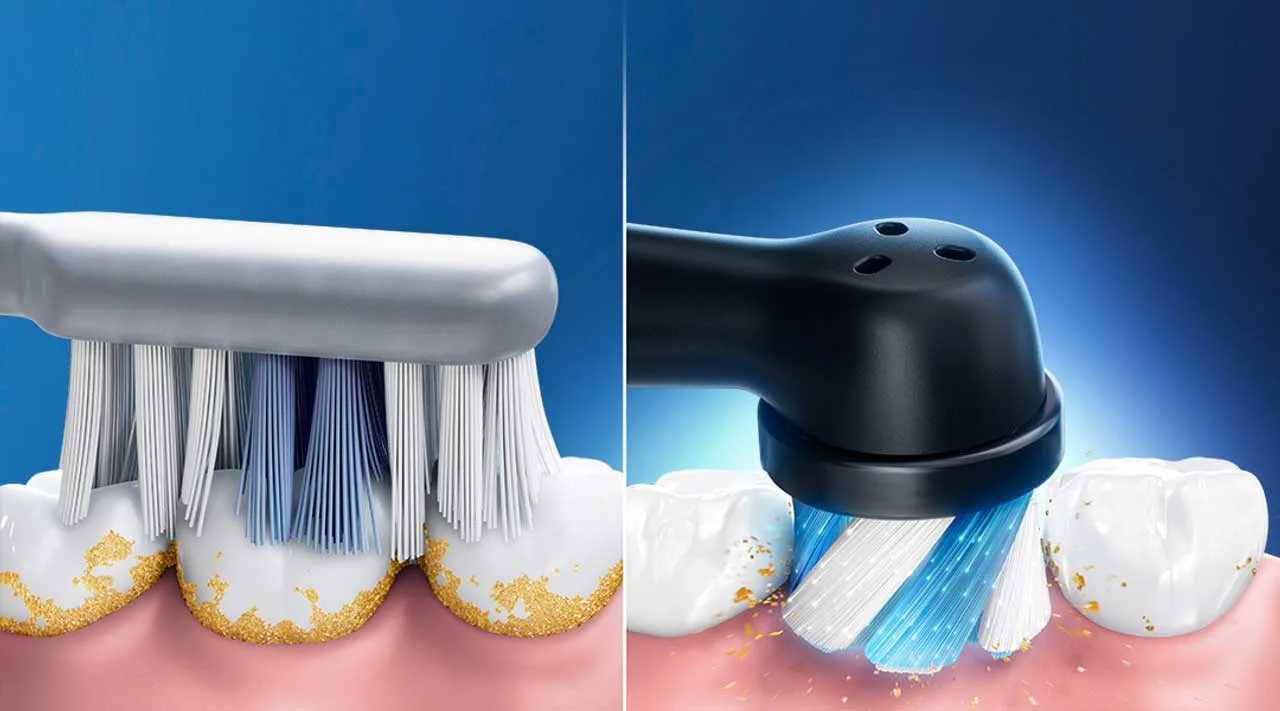 Article - Electric vs. Manual Toothbrushes: Which Is Better? - Spazzolini elettrici e manuali: Che cosa è meglio? - HERO