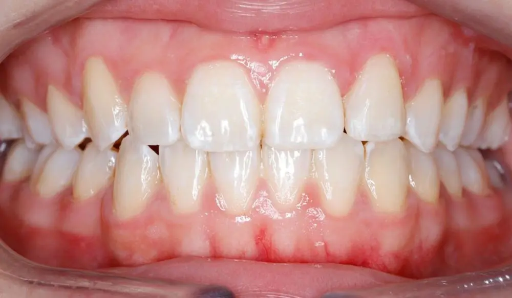 after image