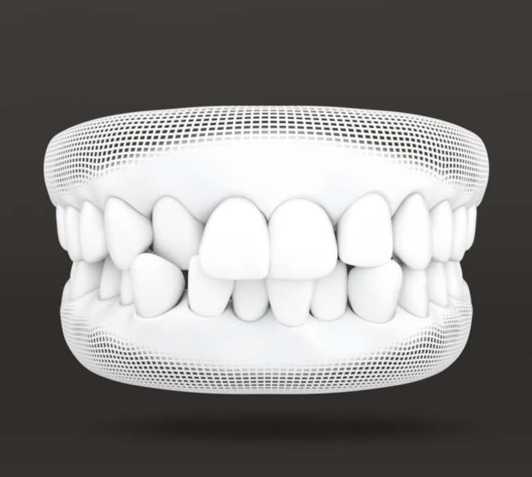 Treatable Cases > Carousel > Malocclusion > Image