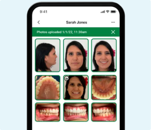 Patient creation and photo capture on Invisalign practice app