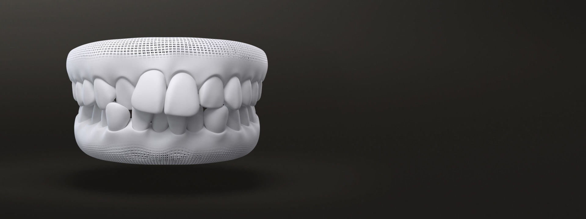 Model crowded teeth - Invisalign Europe