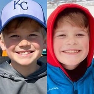 Little boy testimonial before and after treatment with Invisalign® clear aligners