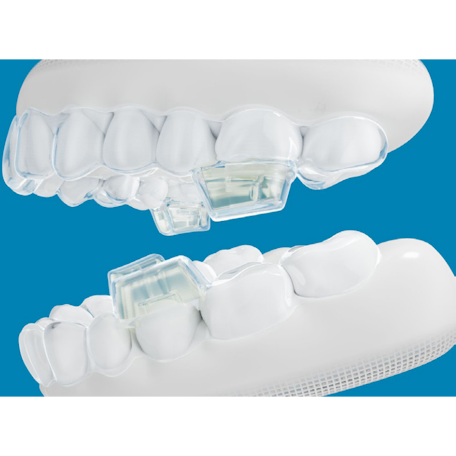 maob-mandibular-occlusal-blocks-text-media