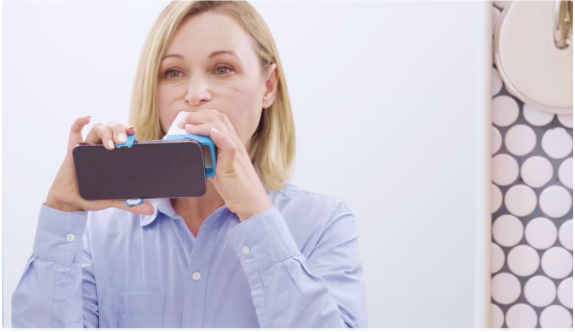 Female patient using Invisalign lens via My Invisalign app for patients