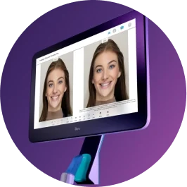 photo-3-up-angled-view-itero-purple-background