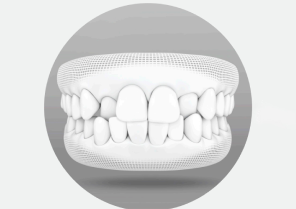 Comprehensive Invisalign Learn Invisalign