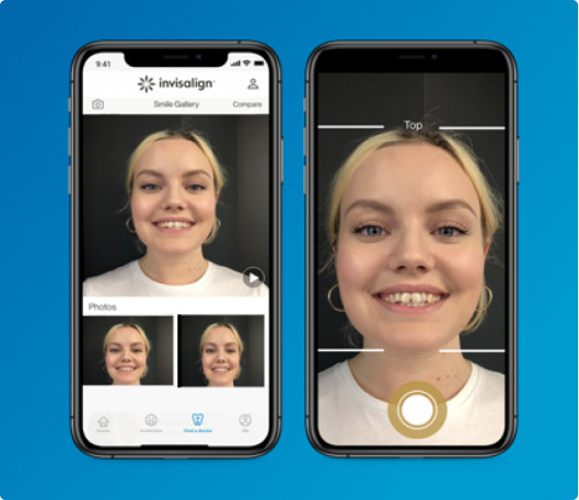 Smile gallery on My Invisalign app mobile view