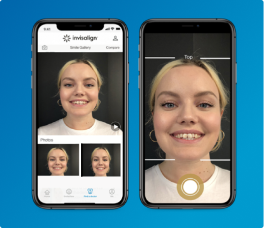 Smile gallery on My Invisalign app mobile view