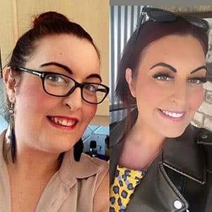 Young woman testimonial before and after treatment with transparent aligners