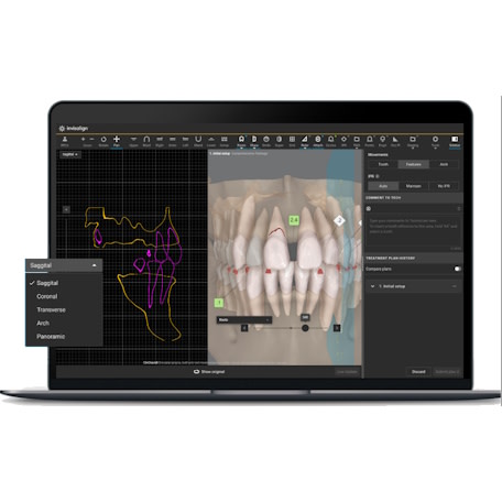 text-image-cbct-plane