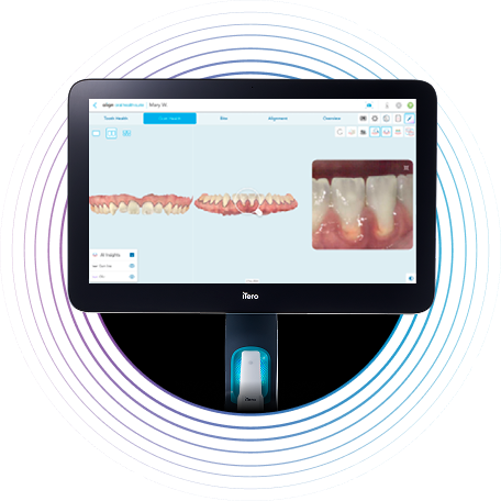 image-accordion-gp-gum-health