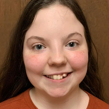 Teen girl before Invisalign® treatment