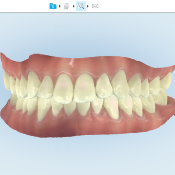 Lekarz Invisalign® pokazuje pacjentce jej nowy uśmiech po leczeniu przezroczystymi nakładkami