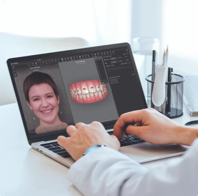 Invisalign doctor using Smile Architect software on a female patient's case