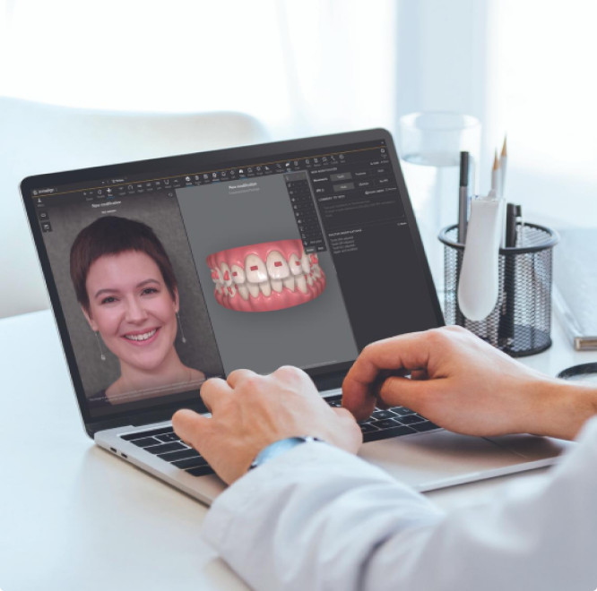 Invisalign doctor using Smile Architect software on a female patient's case