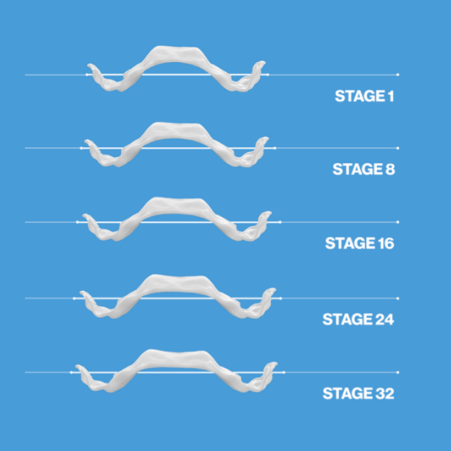 image-text-and-media-expander-stages