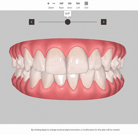 image-text-and-media-q1-clincheck-software