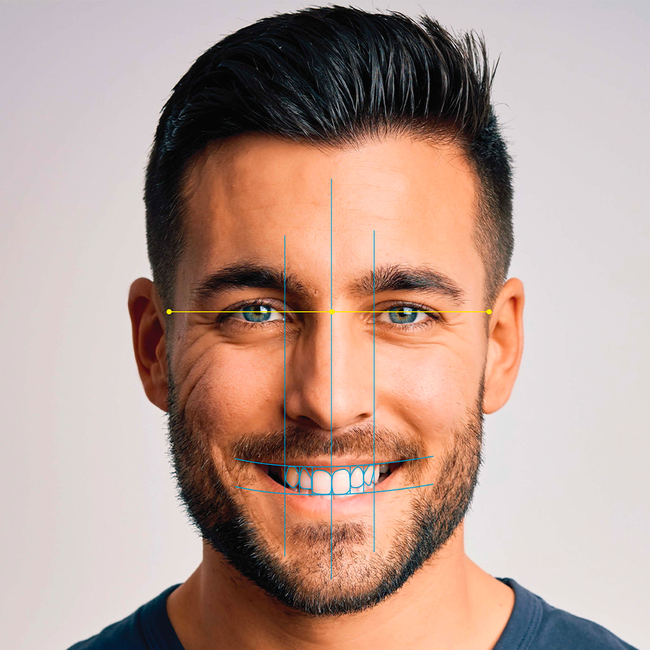 Restorative Procedures-hero-section-8% of surveyed dentists