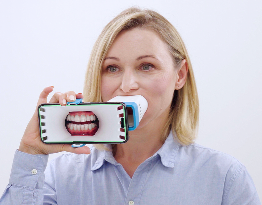 Black woman taking a picture of her tooth using Invisalign Virtual Care AI tool