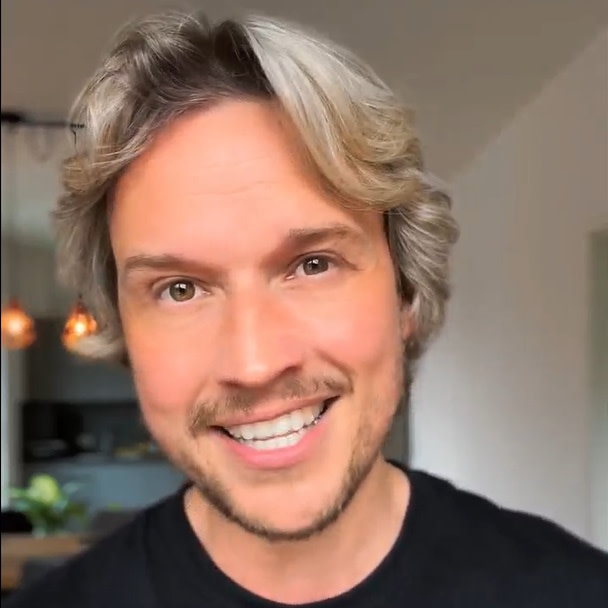 Patientenerfahrungen vor und nach der Invisalign® Behandlung