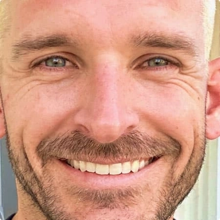 Collin after Invisalign