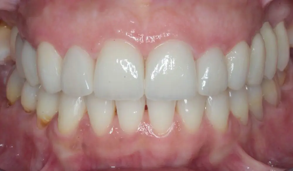 after image