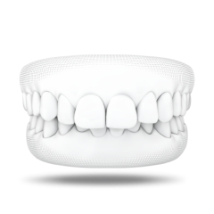 overbite-ww-2 3x