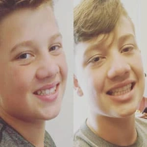 Little boy testimonial before and after treatment with Invisalign® clear aligners