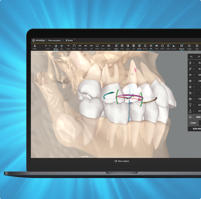 CBCT integration in ClinCheck Pro software