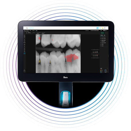 new-xray-insight-monitor-image