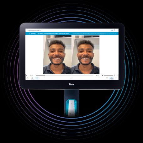 image-accordion-invisalign-smile-video