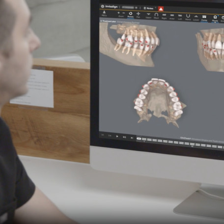 Invisalign doctor checking CBCT integration on ClinCheck Pro software