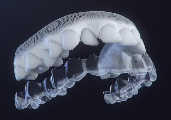 Invisalign Aligners