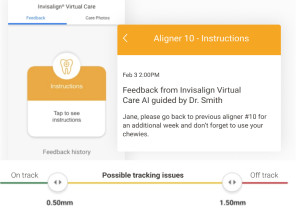 Automated notifications view on My Invisalign app