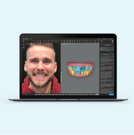Webinar view of Invisalign Smile Architect software