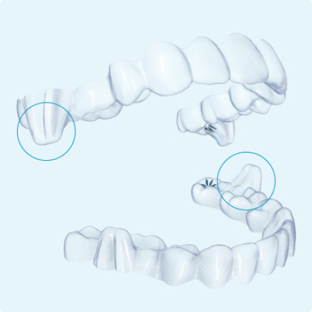 image-text-and-media-aligners-mandibular-advancement