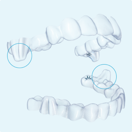 image-text-and-media-aligners-mandibular-advancement