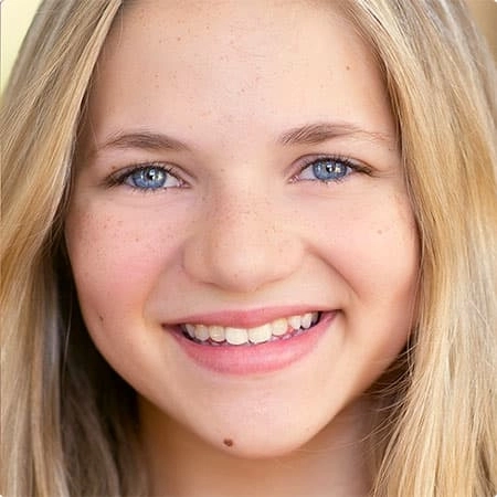 Emerald after Invisalign