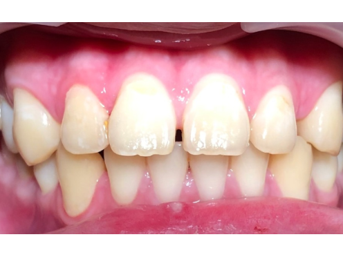 before image