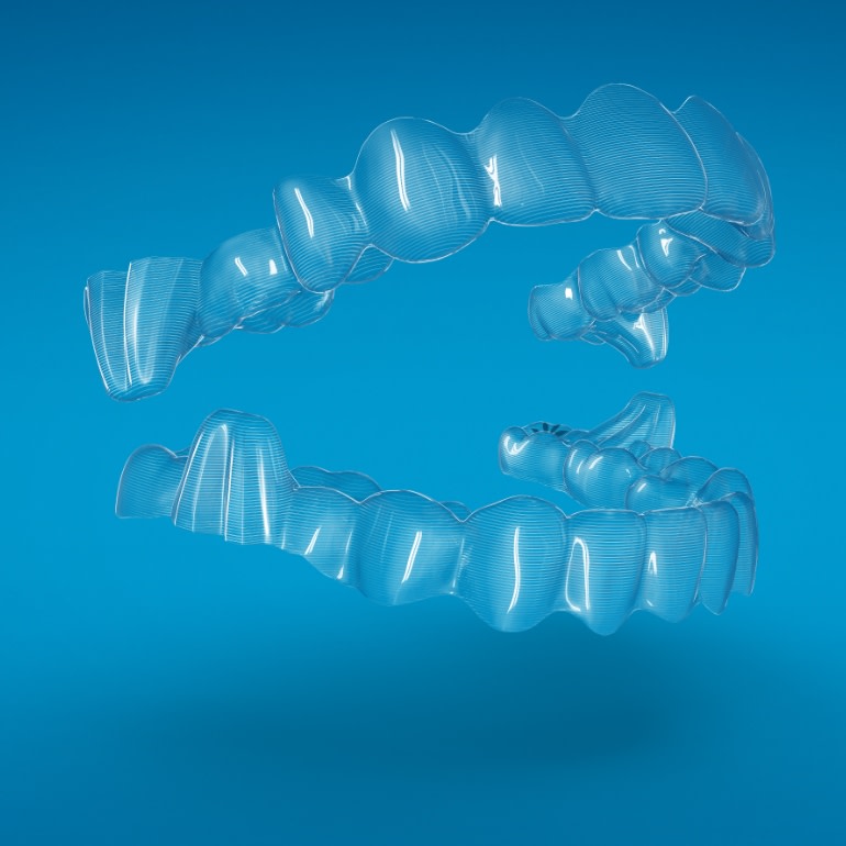 Allineatori trasparenti Invisalign per trattare avanzamento mandibolari